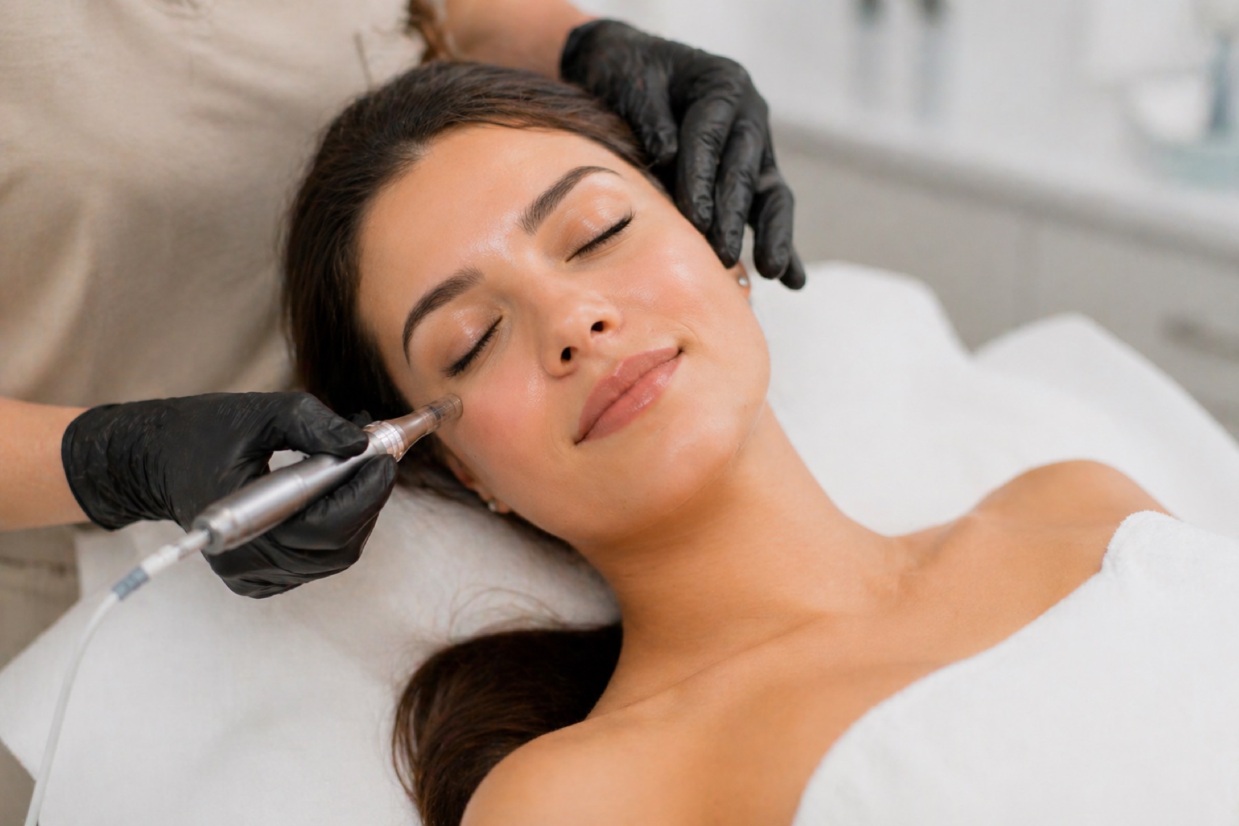 Microneedling Behandlung im Nalé Atelier
