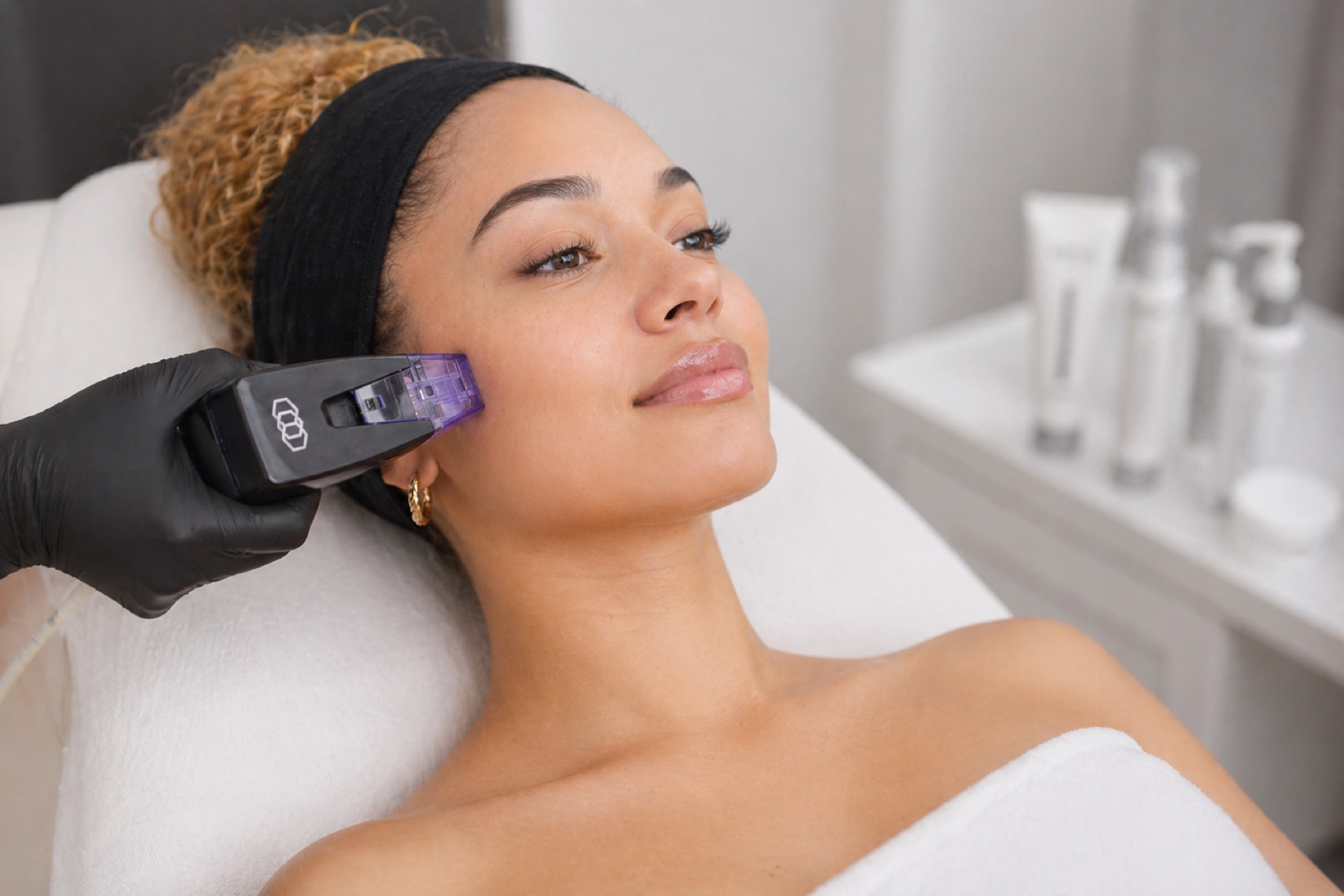 Radiofrequenz-Microneedling Stuttgart